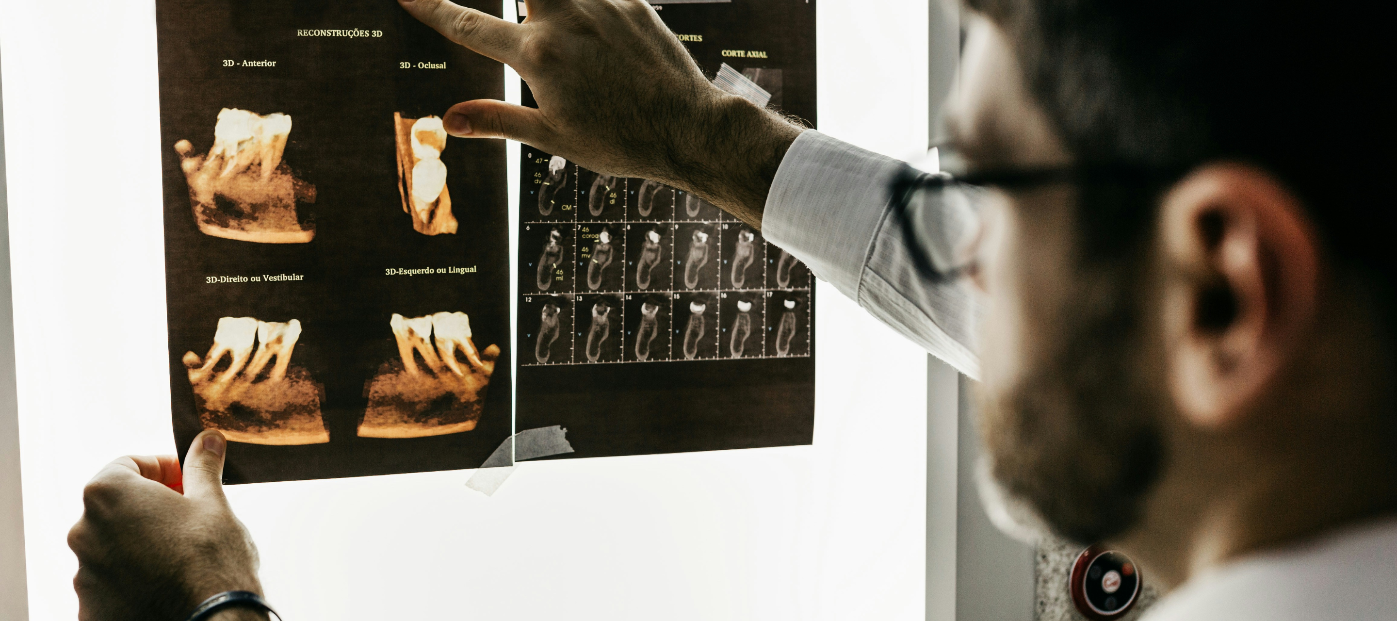 Dentist observing tooth x-ray