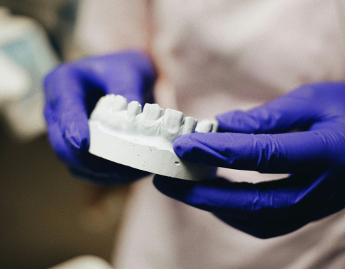 Mould being hold by a dentist